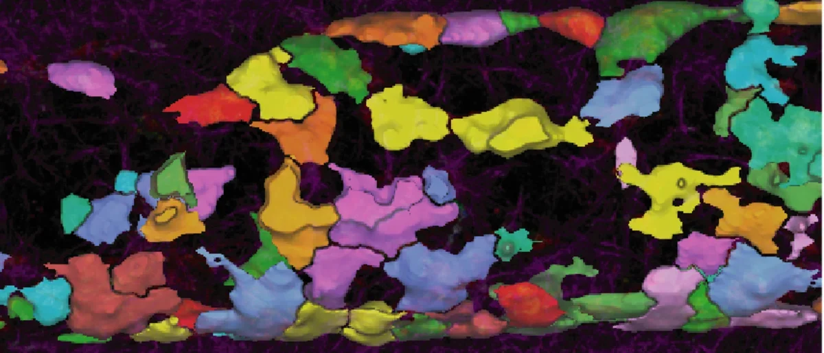 Confocal microscopy of microfluidic cell culture (from screen left to right is the microscope image, the merged segmentation overlying the image, and segmentation alone)