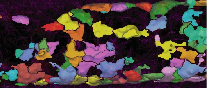 Confocal microscopy of microfluidic cell culture (from screen left to right is the microscope image, the merged segmentation overlying the image, and segmentation alone)